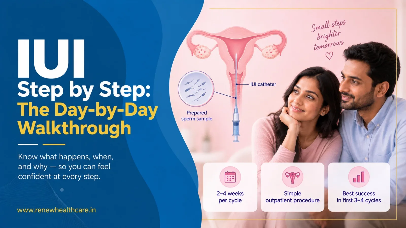 IUI Step by Step: The Day-by-Day Walkthrough Nobody Gives You